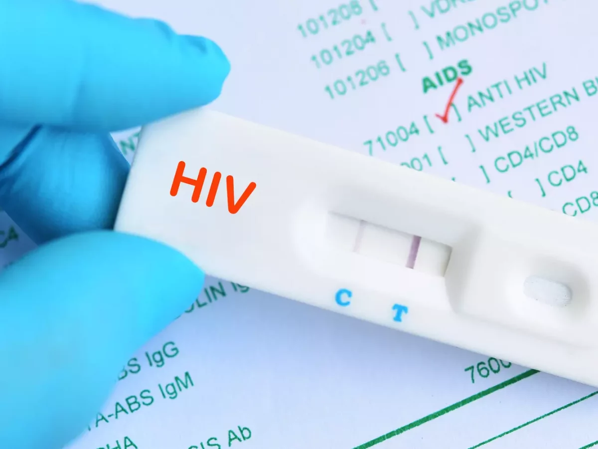 Ложные тесты на ВИЧ при коронавирусе